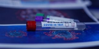 LAS PRUEBAS DE COVID-19 SON CADA VEZ MÁS ACCESIBLES LAS PRUEBAS DE COVID-19 SE FACILITAN CADA VEZ MÁS