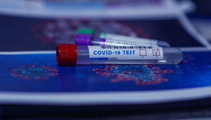 LAS PRUEBAS DE COVID-19 SE FACILITAN CADA VEZ MÁS